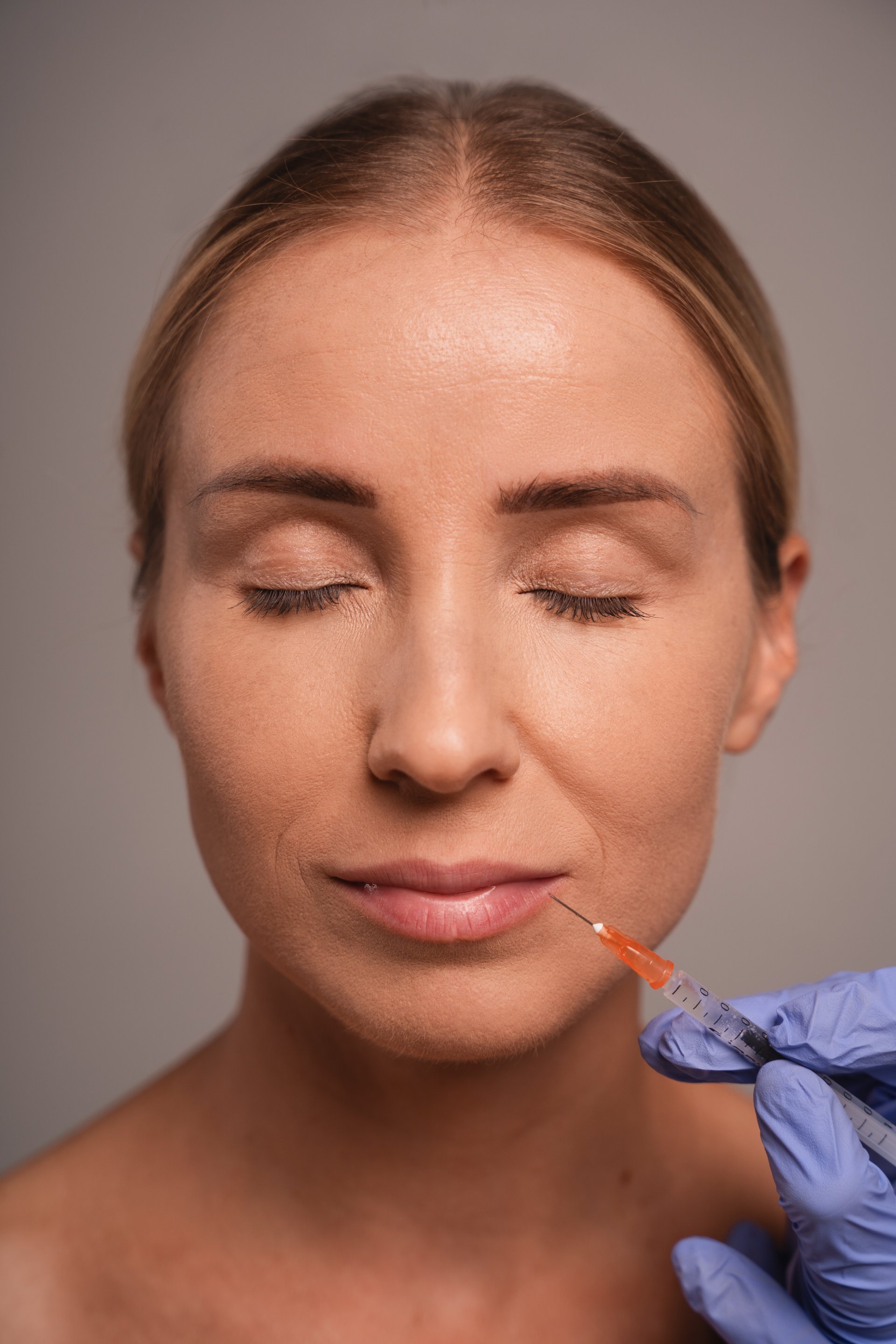 Juvederm