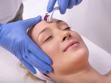Microneedling
