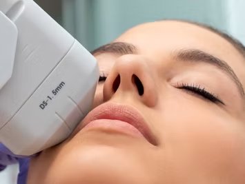 Ultherapy
