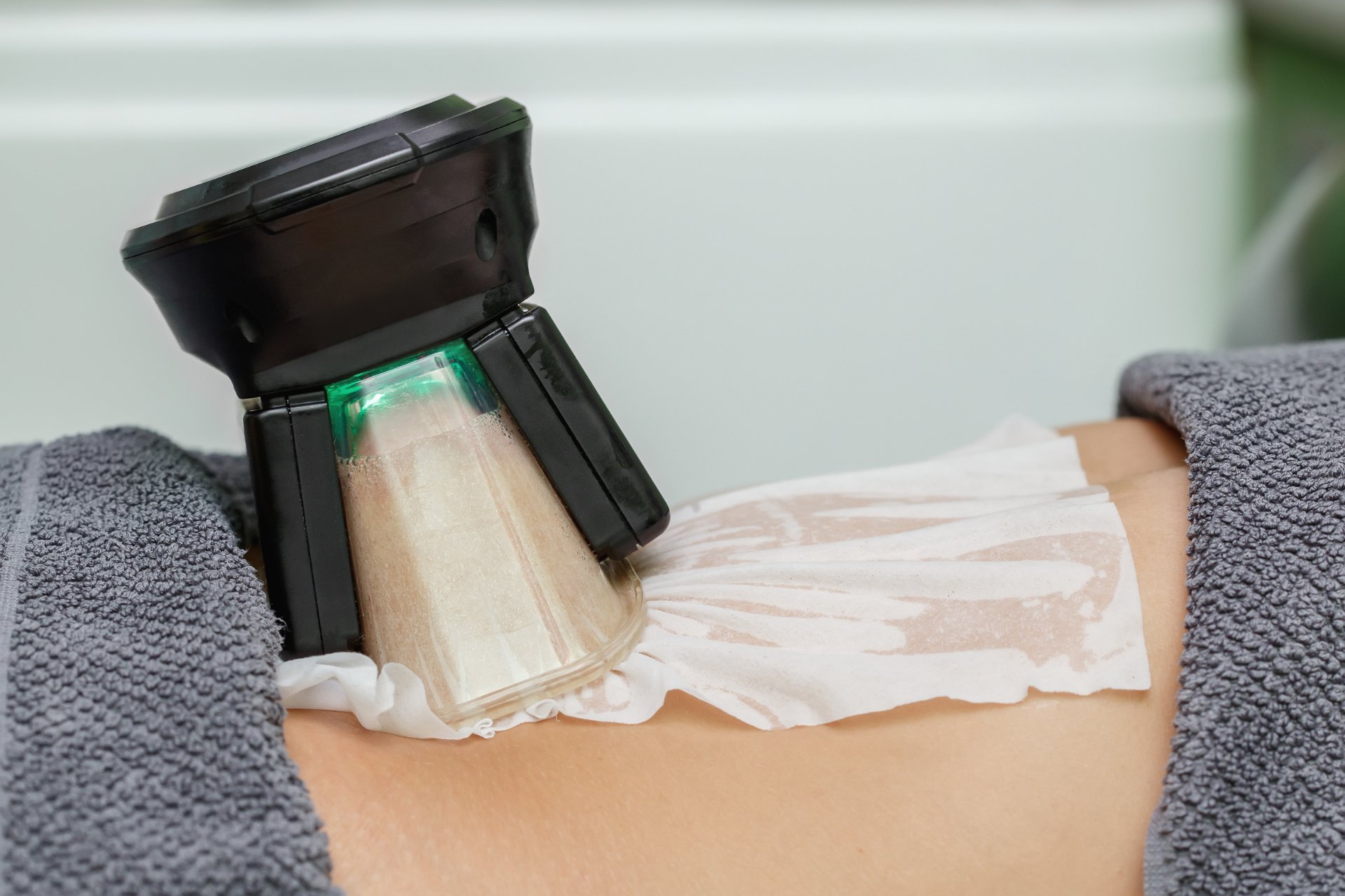 Cryolipolysis